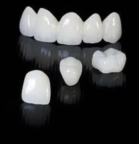氟斑牙祛除方法