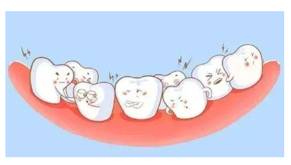 牙齿畸形、凸嘴，该如何矫正呢？